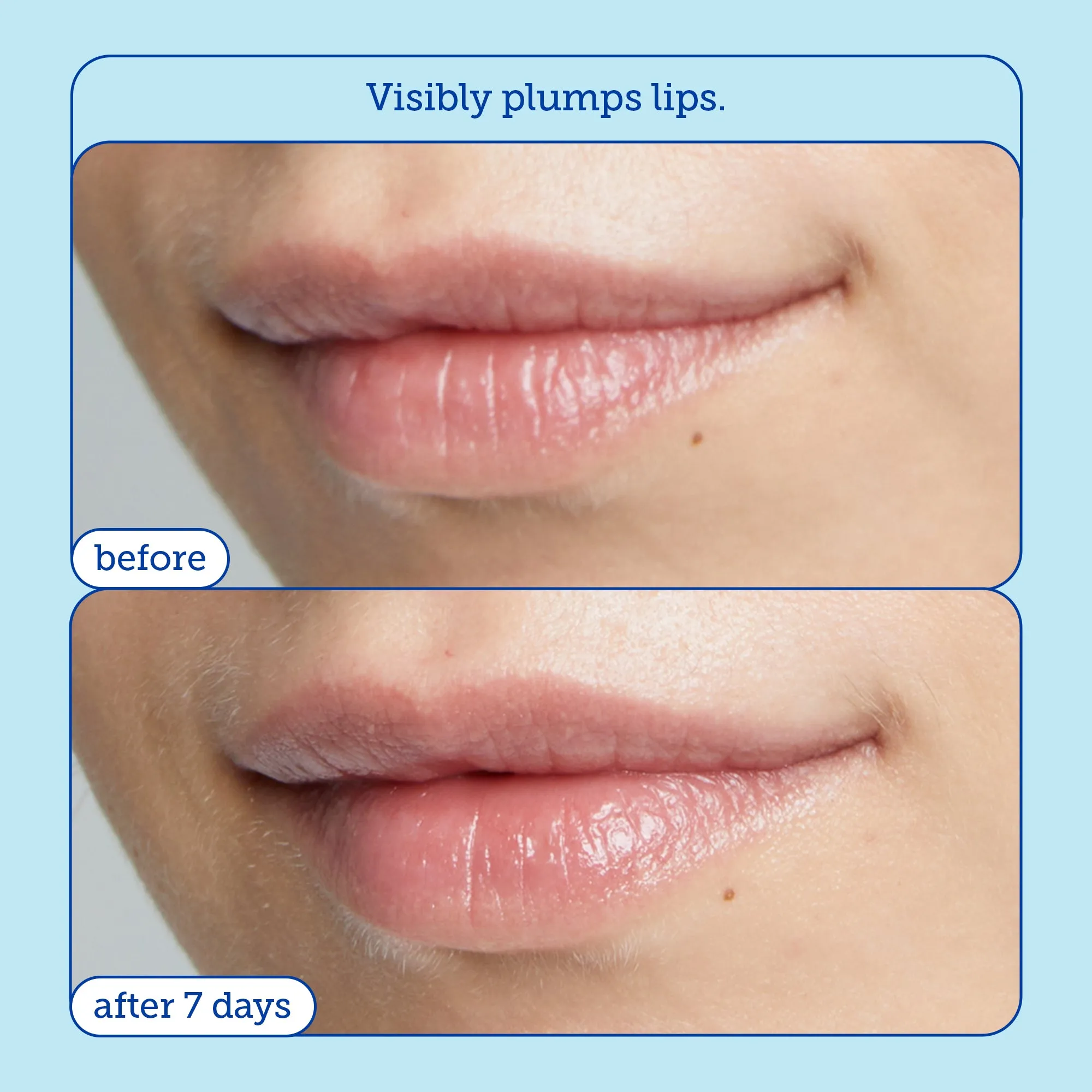 Barrier  Triple Lipid Lip Treatment