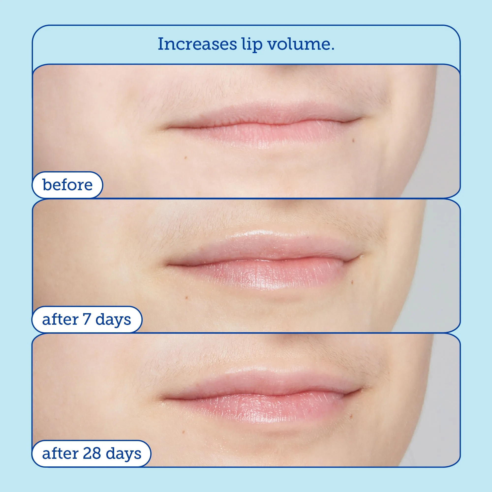 Barrier  Triple Lipid Lip Treatment